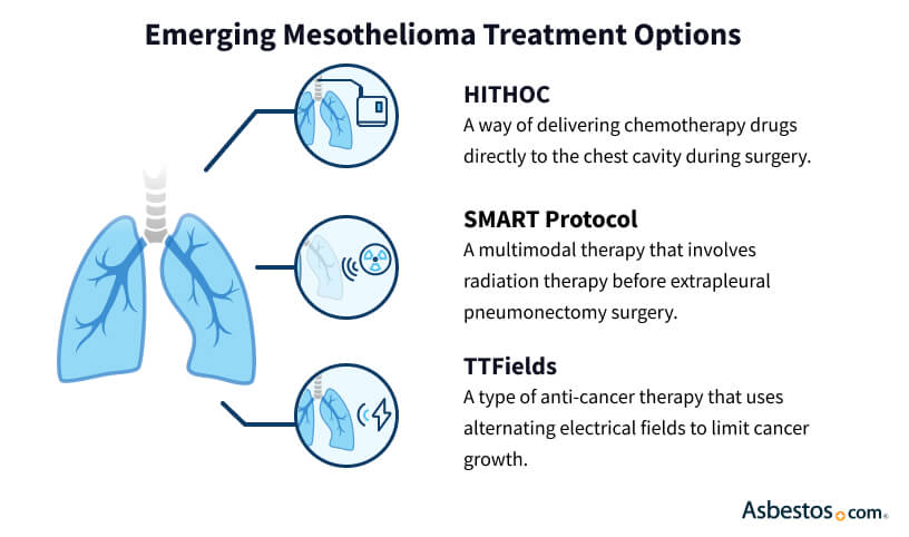    Latest Mesothelioma Treatment Options 